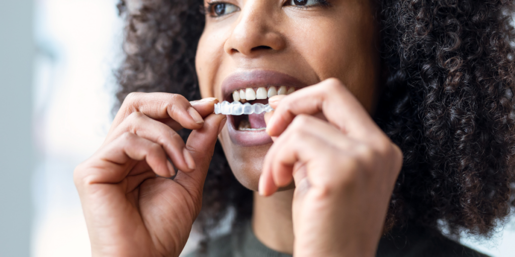 ➨ Orthodontics: Braces Trap Plaque and Require Professional Intervention