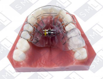 The Homeoblock™ Protocol