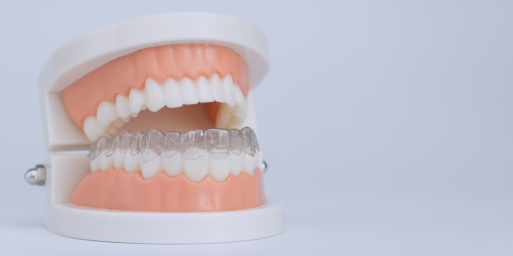 Safety + Longevity - retainers