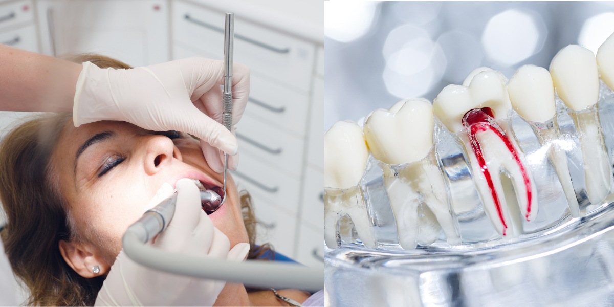 Still Sore After a Filling_ Why It Might Be Root Canal Time