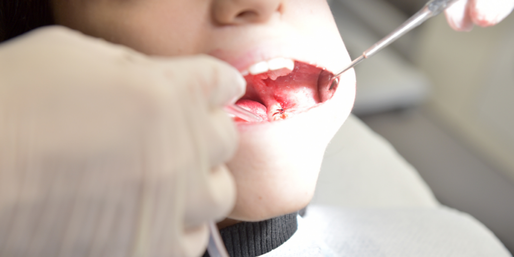 What is periodontal therapy