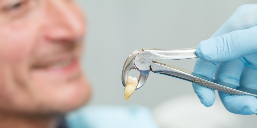 What to Expect from Wisdom Teeth Removal in Clifton