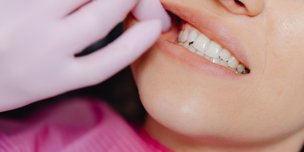 Wisdom Teeth Without Pain - Feture image