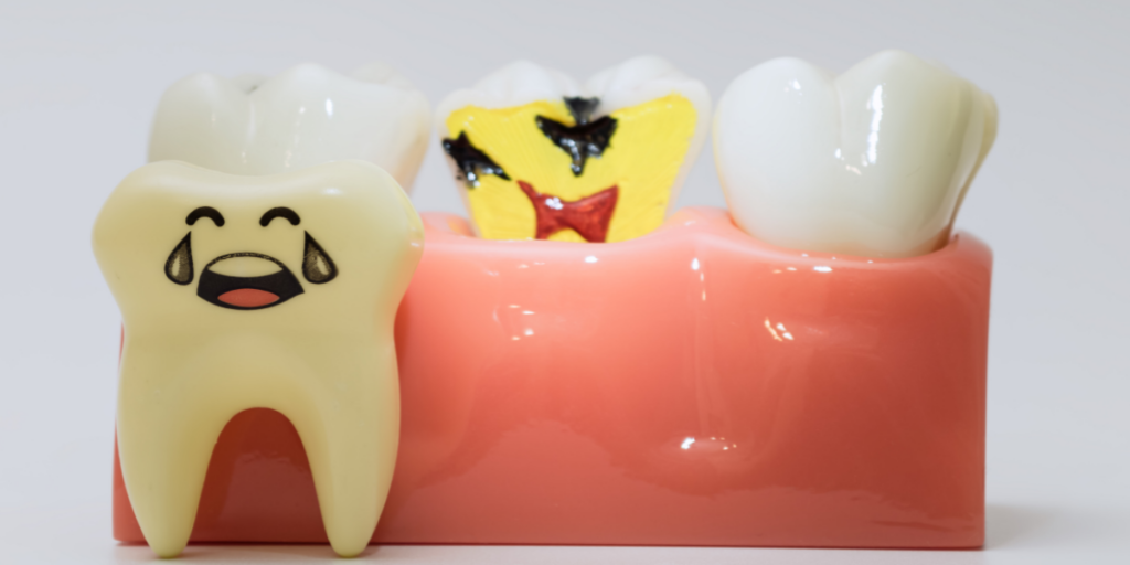 What Causes an Abscessed Tooth?
