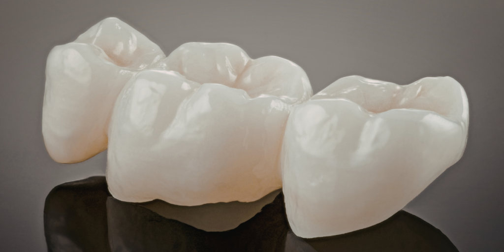 Why a Crown Is Often Necessary for a Painless Cracked Tooth