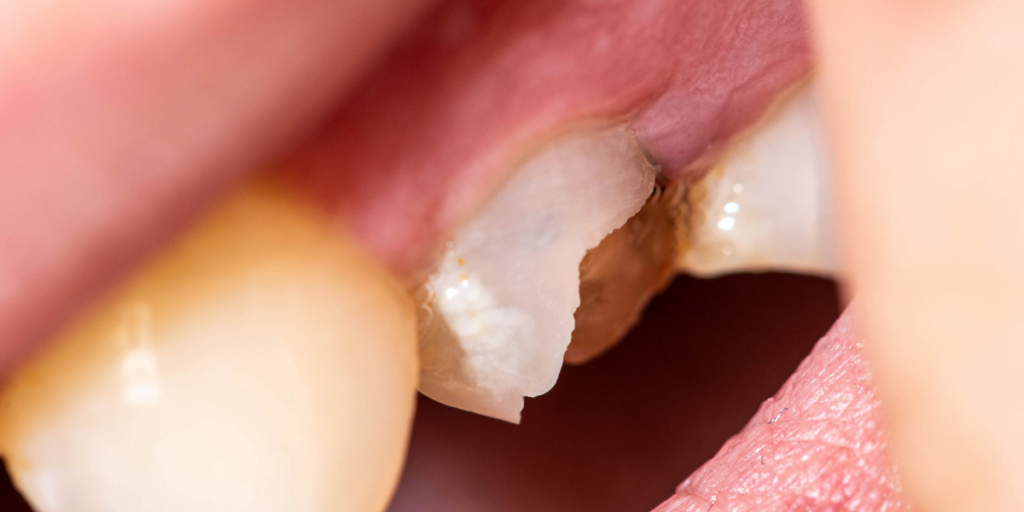 Signs You May Need Treatment 