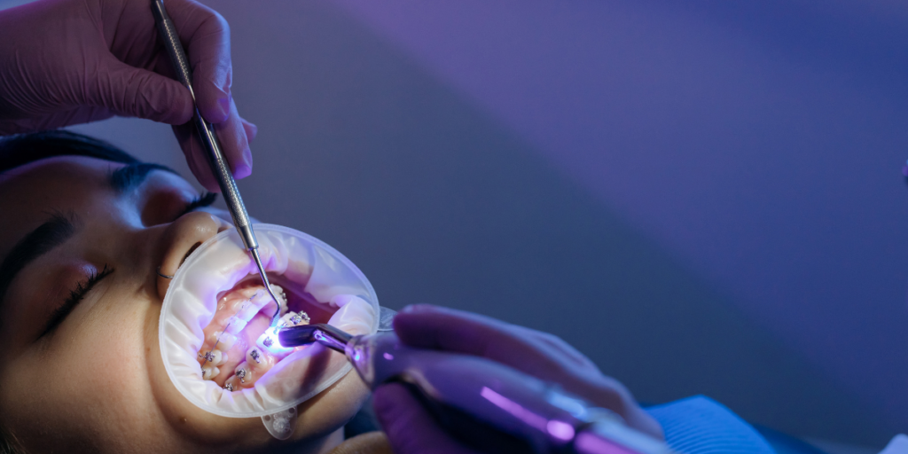 Average Timeline For Orthodontic Treatment