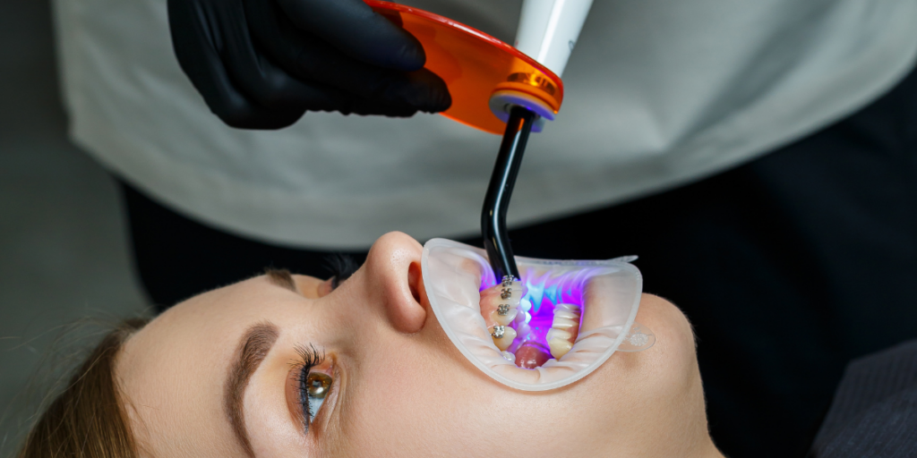 Why Do Some Orthodontic Treatments Take Longer Than Others? Questions to Ask Your Orthodontist in Clifton