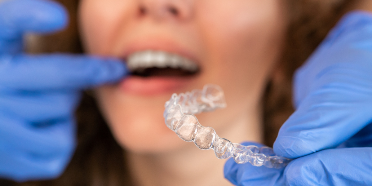 How Harmony Dental Arts Deliver Personalized Invisalign Care
