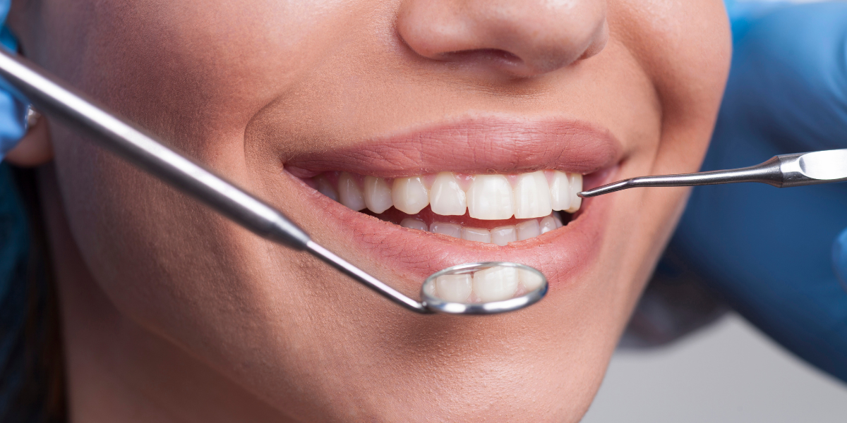 How Often Should You Get a Dental Cleaning?
