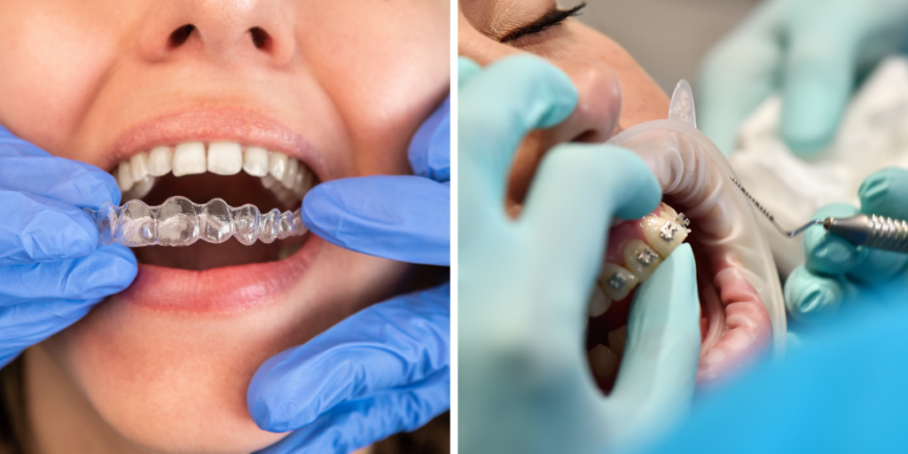 How Tongue Thrusting Can Affect Your Braces or Invisalign