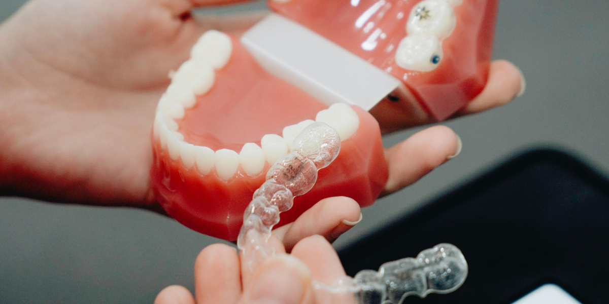 Why Invisalign Timelines Vary So Much
