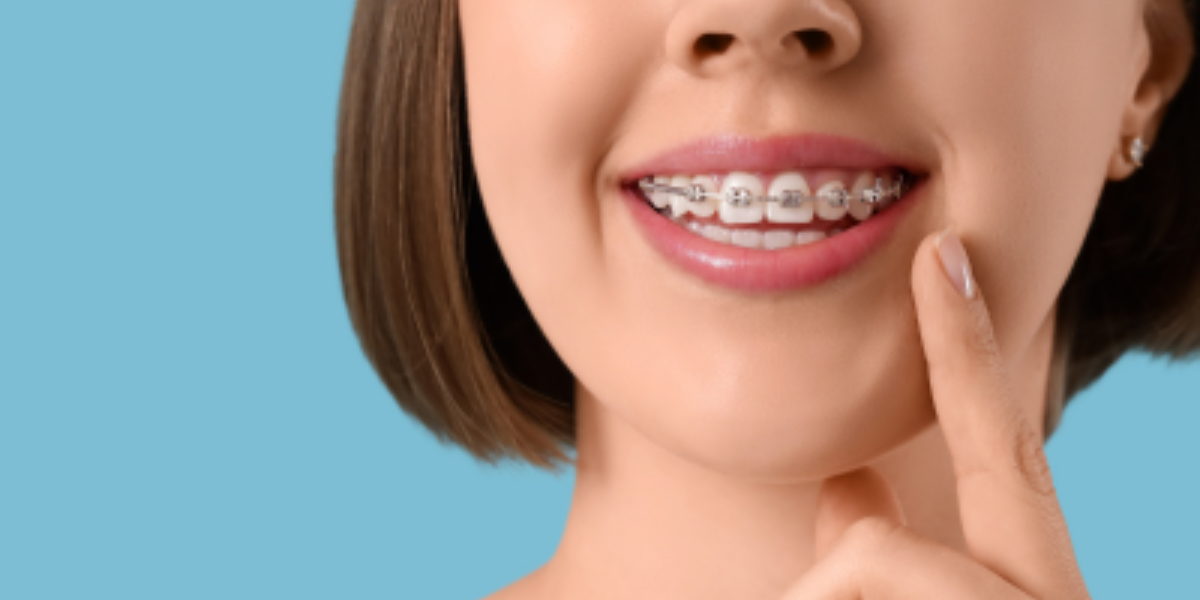 Potential Consequences Of Braces Treatment Interruption
