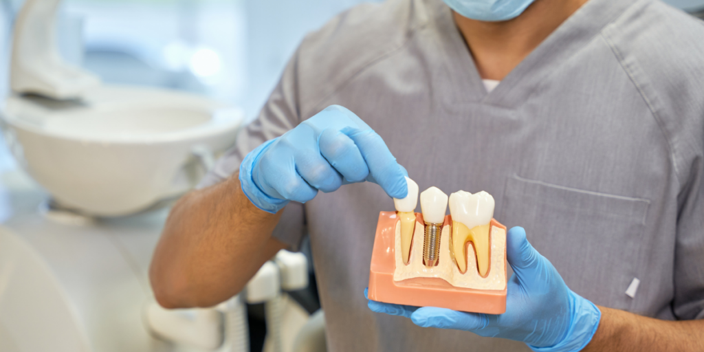 Dental Implant Consultation Checklist: 9 Questions to Ask Before Choosing an Implant Dentist in Clifton