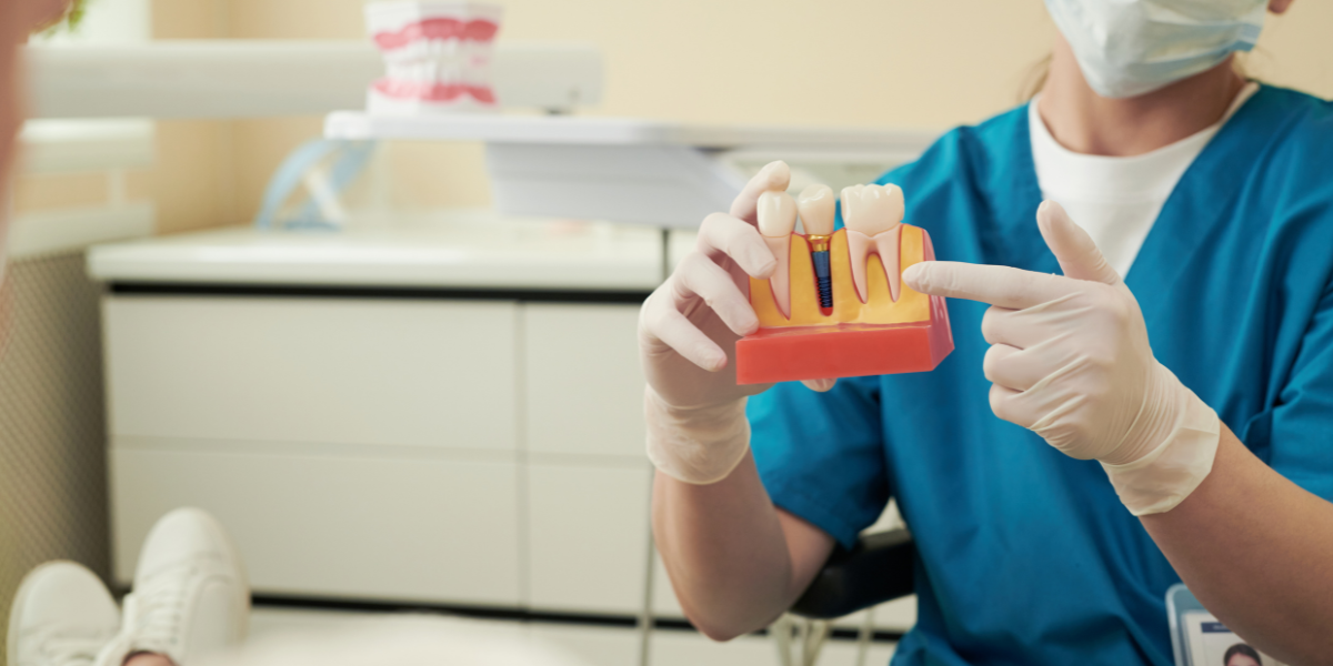 Question #1 – How Much Experience Do You Have With Dental Implants?