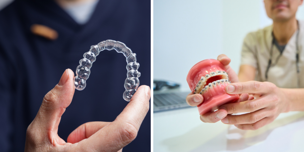 Invisalign vs Braces Explained
