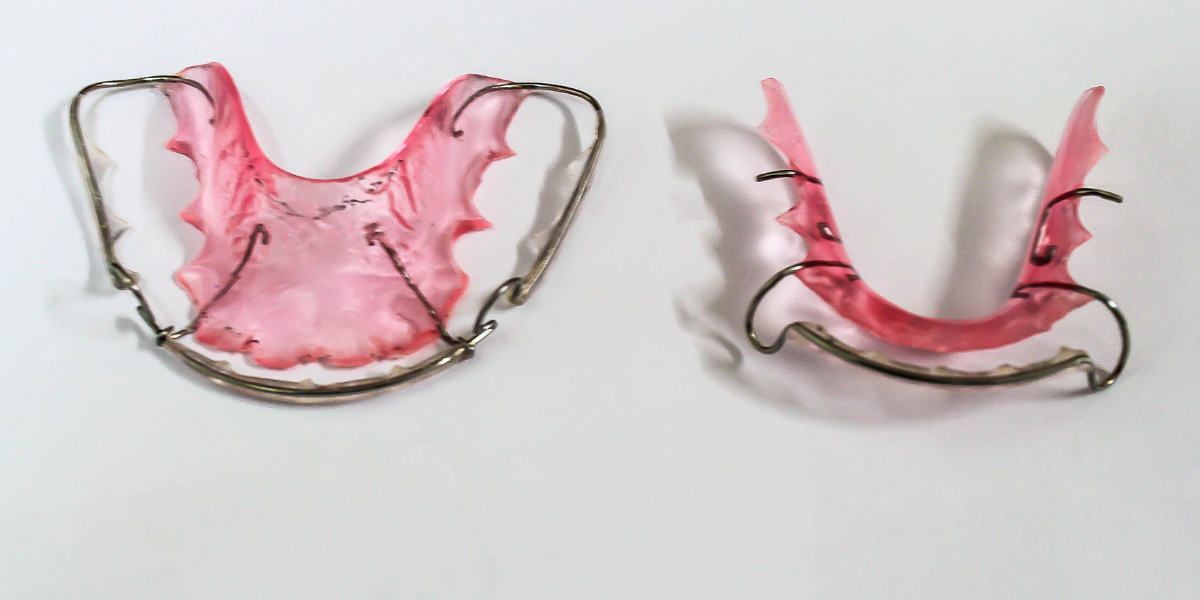 Lost or Broken Retainer? What Clifton Patients Should Do in the First 24 Hours