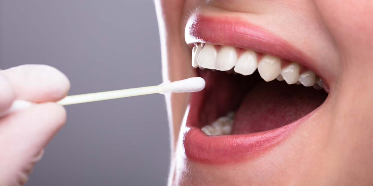 Quick Answer: What Can a Dental Saliva Test Reveal?
