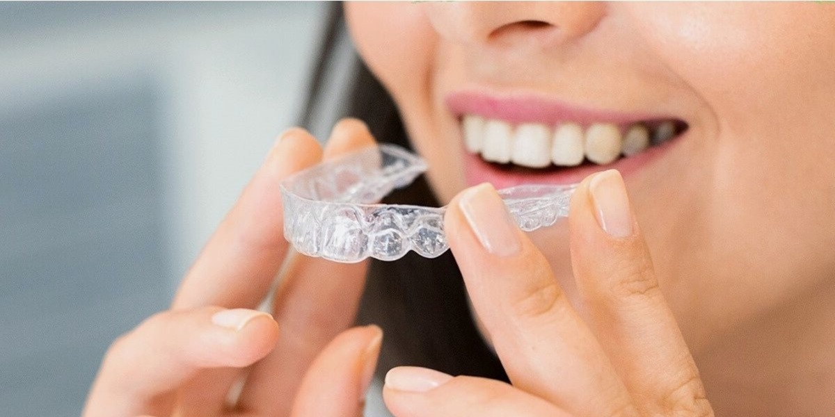 Why Treatment Order Matters When Combining Invisalign and Dental Implants