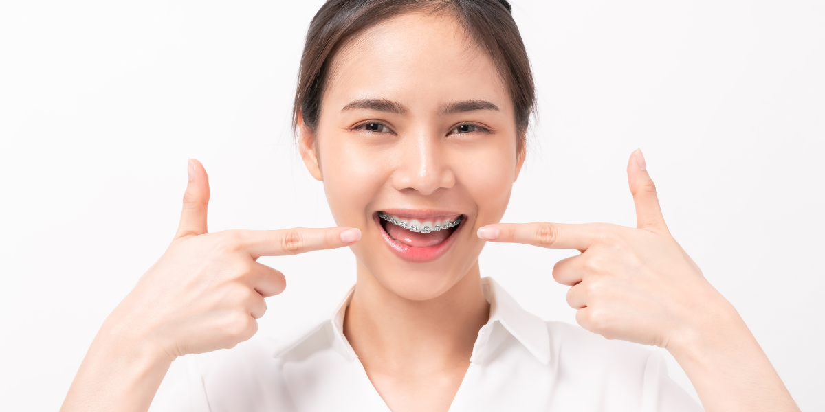 What Should Adults Expect Before Getting Braces in Clifton?