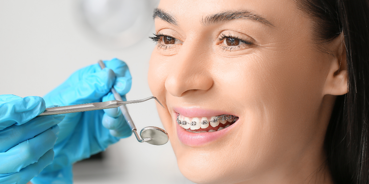 Can You Be Too Old for Braces?