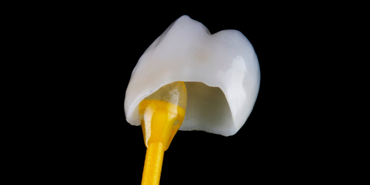 Who may be a candidate for a same-day dental crown?