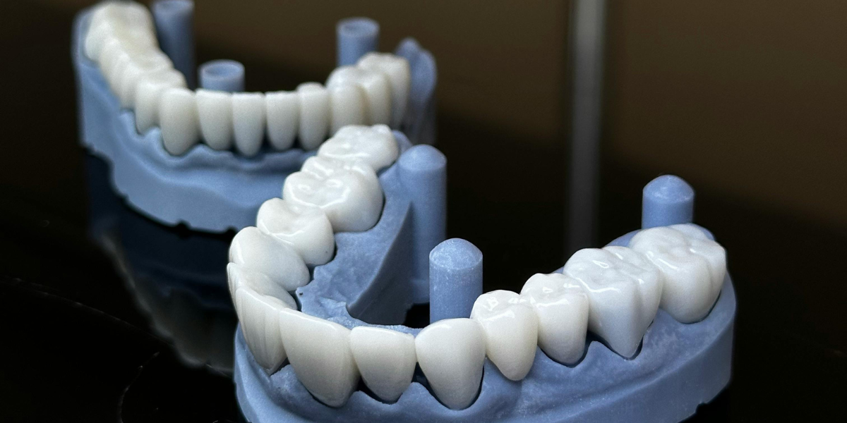 Same-day crowns versus traditional crowns: What is the difference?