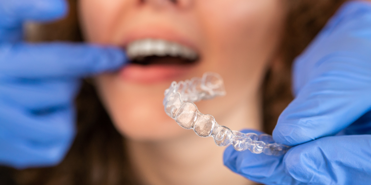 Can Invisalign fix an open bite caused by tongue thrust?
