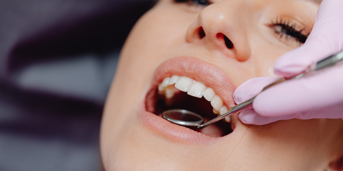 I Received a Large Full-Mouth Treatment Plan—What Should a Second Opinion Include?