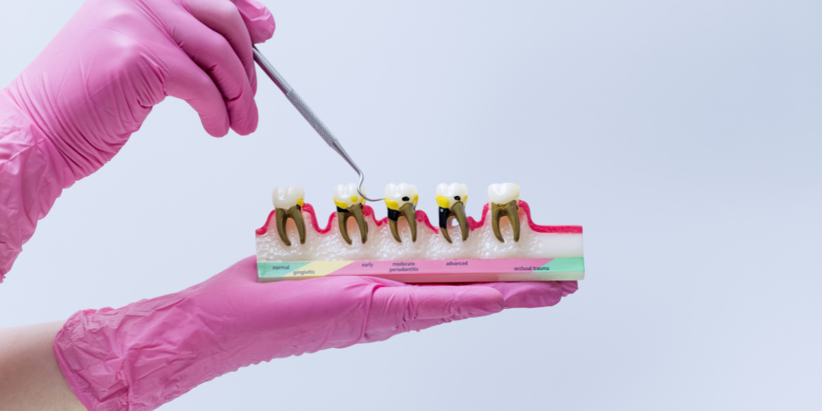 Periodontal, Root, and Bone Health