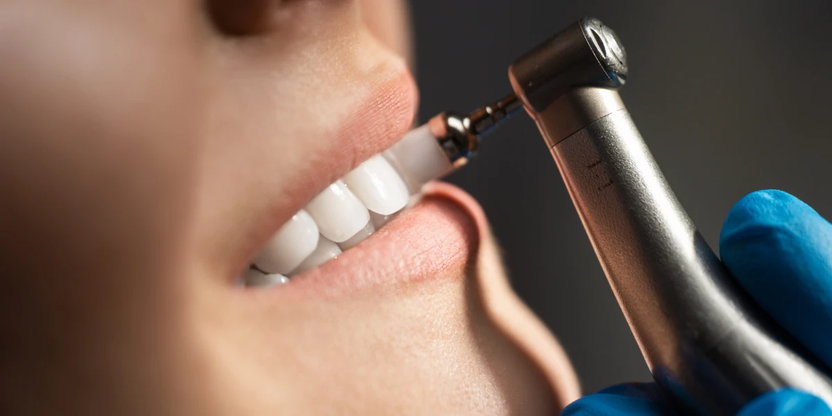 Does a Dental Cleaning Damage Your Enamel_ Separating Fact from Fiction