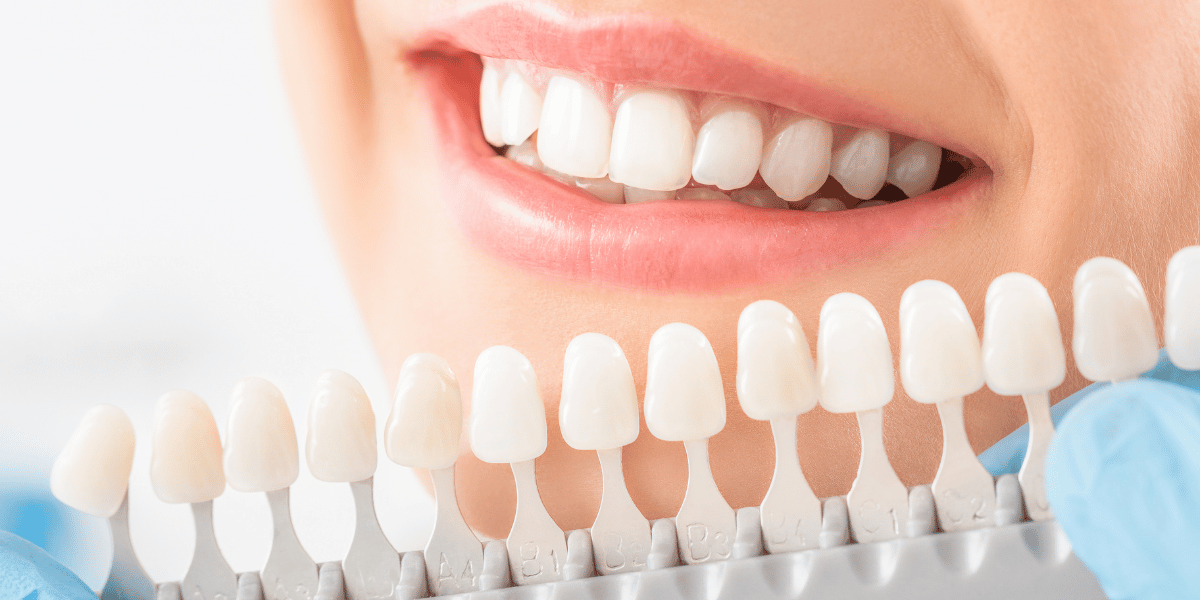Why White Spots on Teeth Do Not All Mean the Same Thing