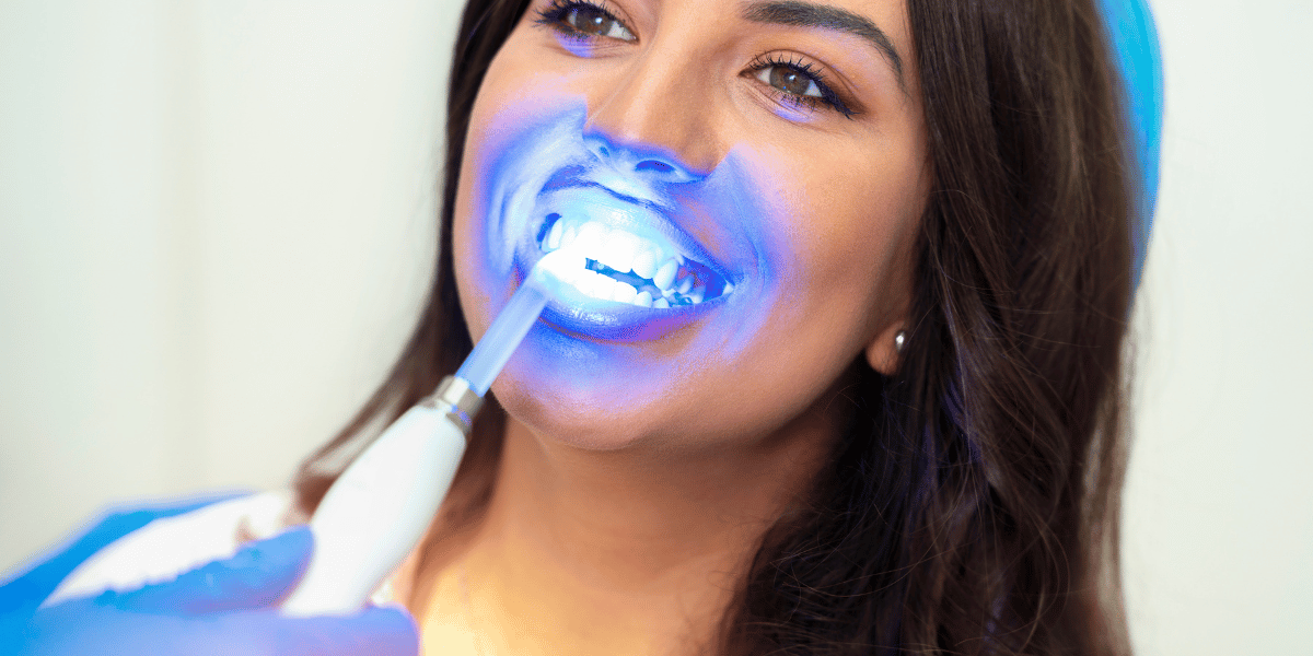 Why White Spots Can Sometimes Look More Noticeable During Whitening
