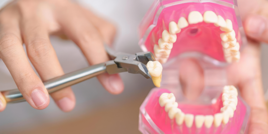 Does Every Dental Emergency Require Tooth Extraction?